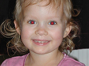 Как убрать эффект красных глаз