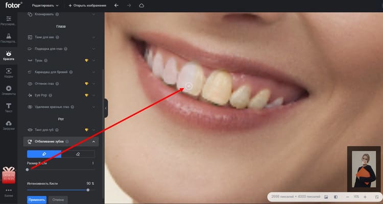 Осветлить зубы на фото