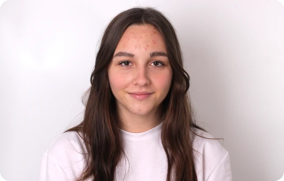 Изображение до