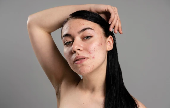 Изображение до