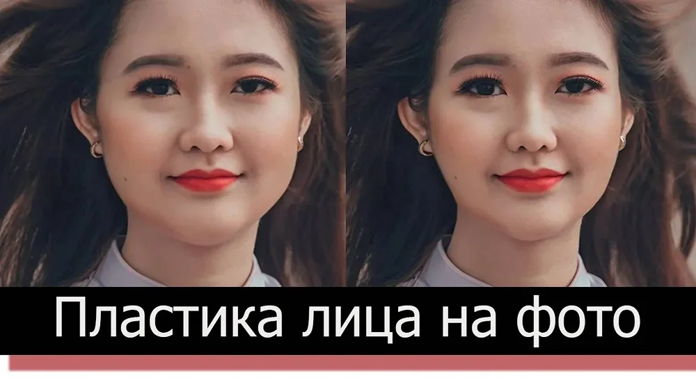 Видео пластика лица